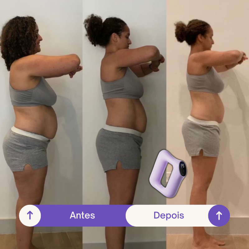 SlimShape - Anel Massageador