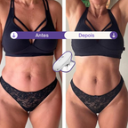 SculpLift - Dispositivo 3 em 1 para Flacidez Localizada