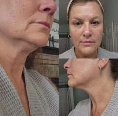 DrenaFace – Escova de Drenagem Linfática Facial