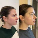 DrenaFace – Escova de Drenagem Linfática Facial