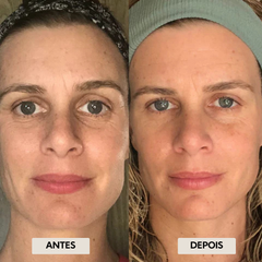 DrenaFace – Escova de Drenagem Linfática Facial