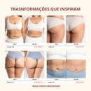 Antes e depois de diferentes mulheres mostrando resultados reais com o uso do Drena Roller para reduzir inchaço e melhorar a textura da pele