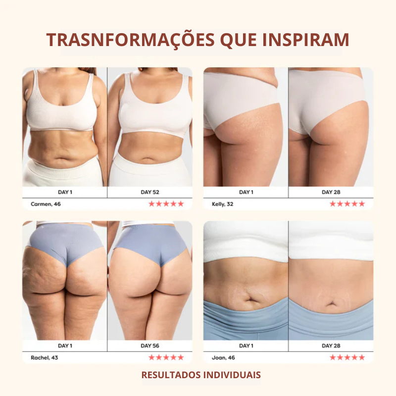 Antes e depois de diferentes mulheres mostrando resultados reais com o uso do Drena Roller para reduzir inchaço e melhorar a textura da pele