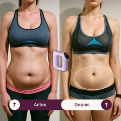 SlimShape - Anel Massageador