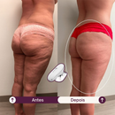 SculpLift - Dispositivo 3 em 1 para Flacidez Localizada