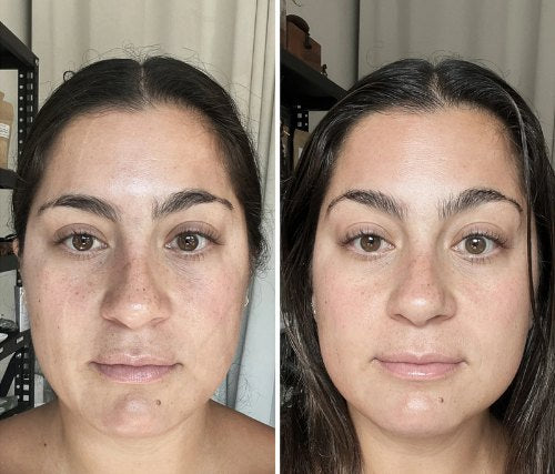 Rosto de frente, antes e depois do uso da DrenaFace